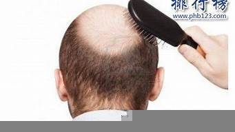 2024年脫發(fā)產(chǎn)品排行榜前十名 科學評測與選購指南